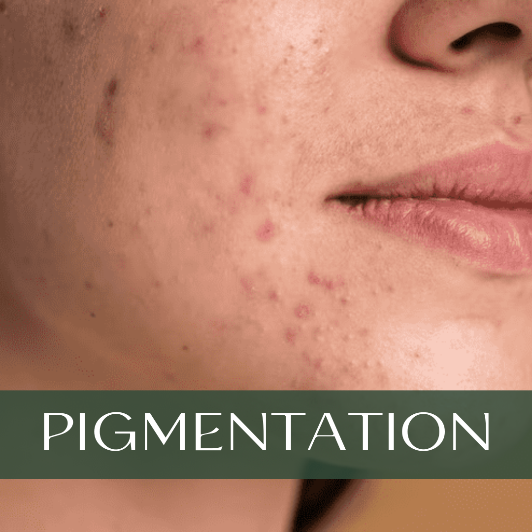 Woman with dark spots and pigmented skin