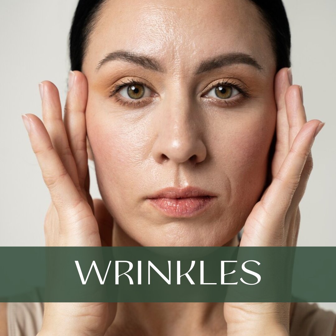 Woman with fine lines and wrinkles