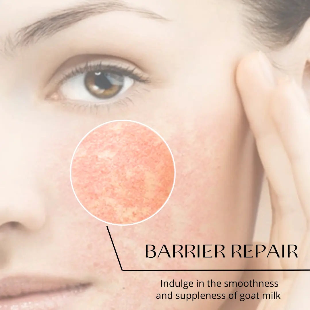 Woman with damaged Skin barrier