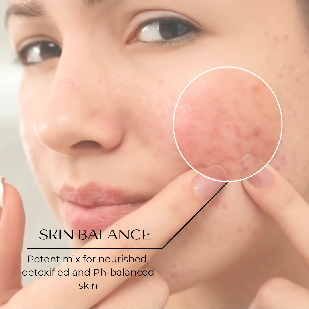 Woman with acne prone skin