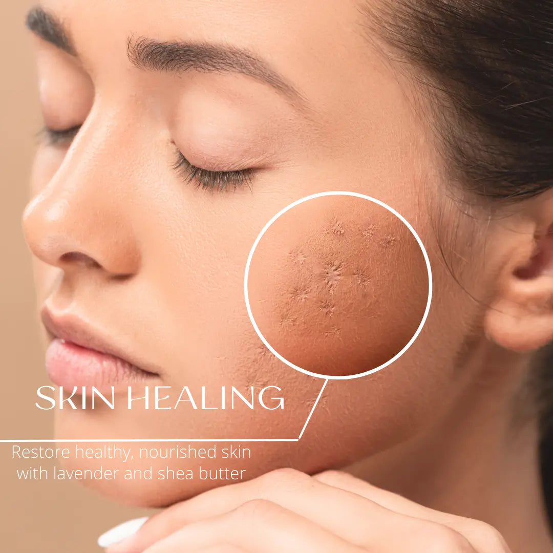 Woman with scarring skin