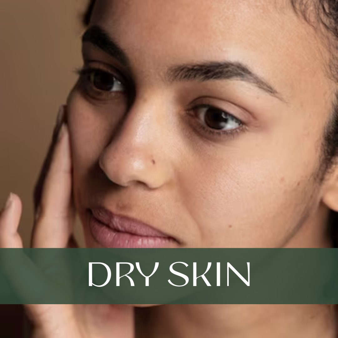 Woman with dry skin touching her cheek with hands