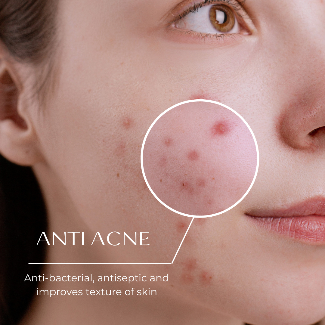 Darzata Skin Care- Anti Acne Natural Cold-Pressed Soap