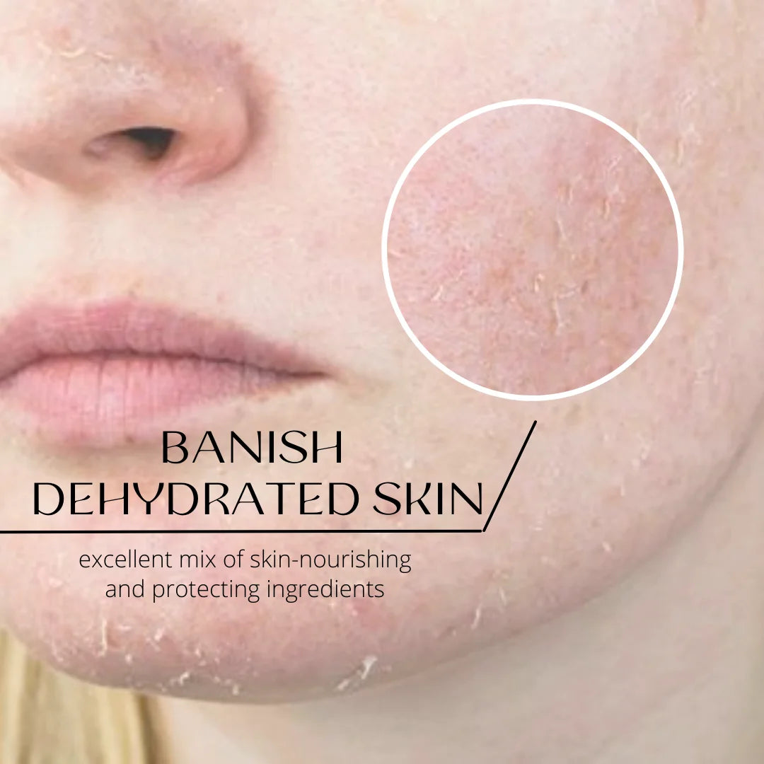 Woman with dry and dehydrated skin